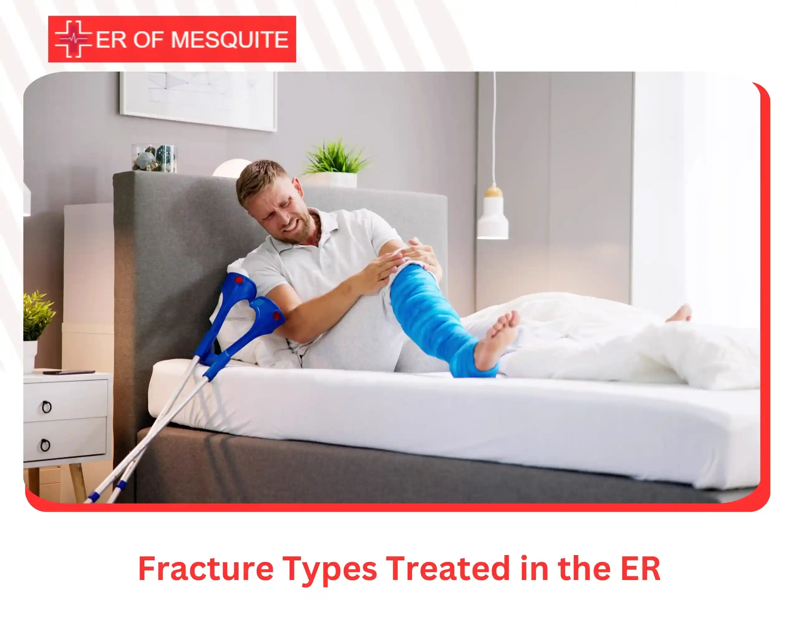 Fracture Types Treated in the ER