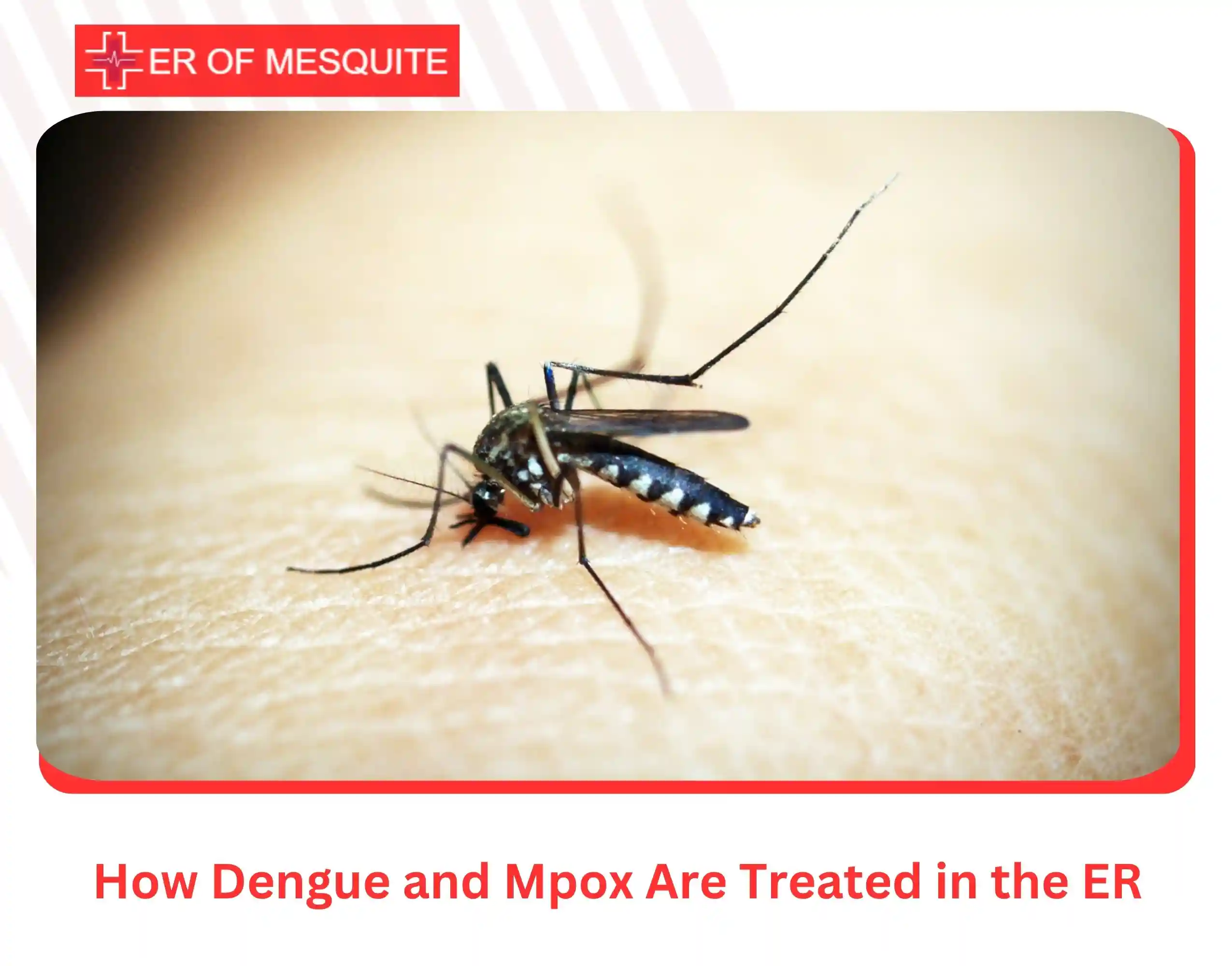 How Dengue and Mpox Are Treated in the ER