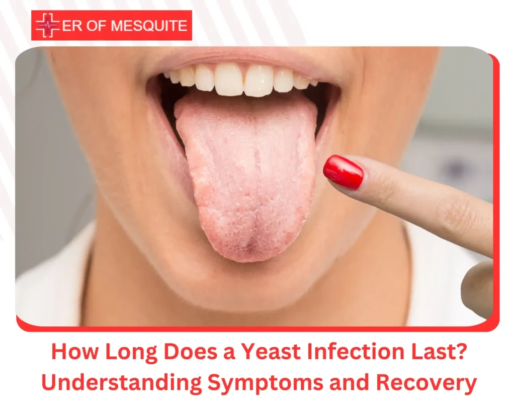How Long Does a Yeast Infection Last Understanding Symptoms and Recovery