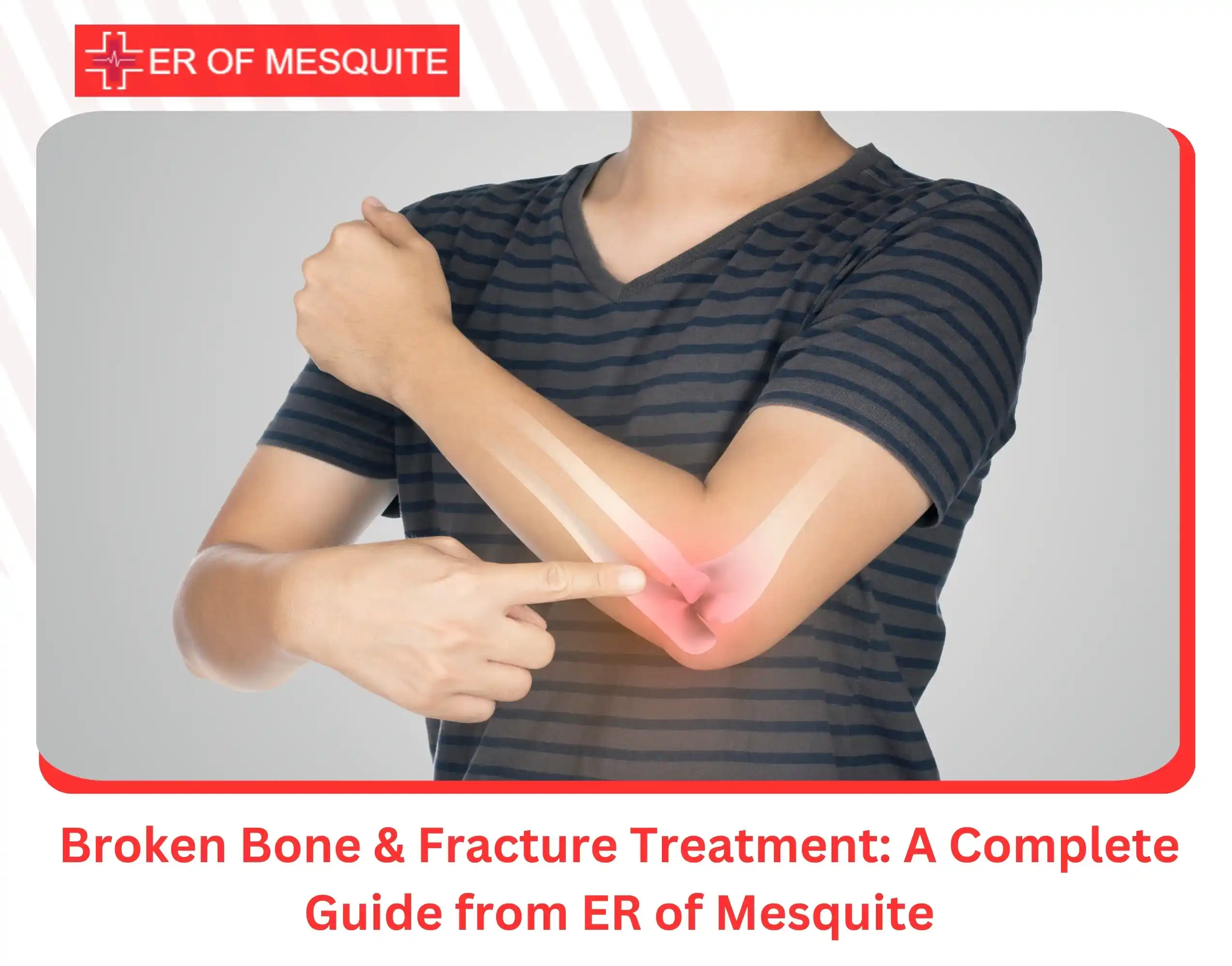 Broken Bone & Fracture Treatment A Complete Guide from ER of Mesquite