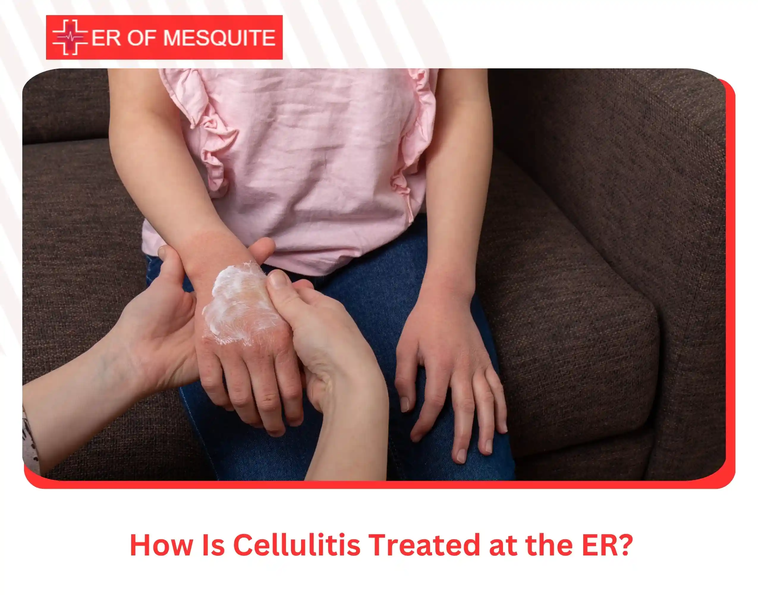 How Is Cellulitis Treated at the ER