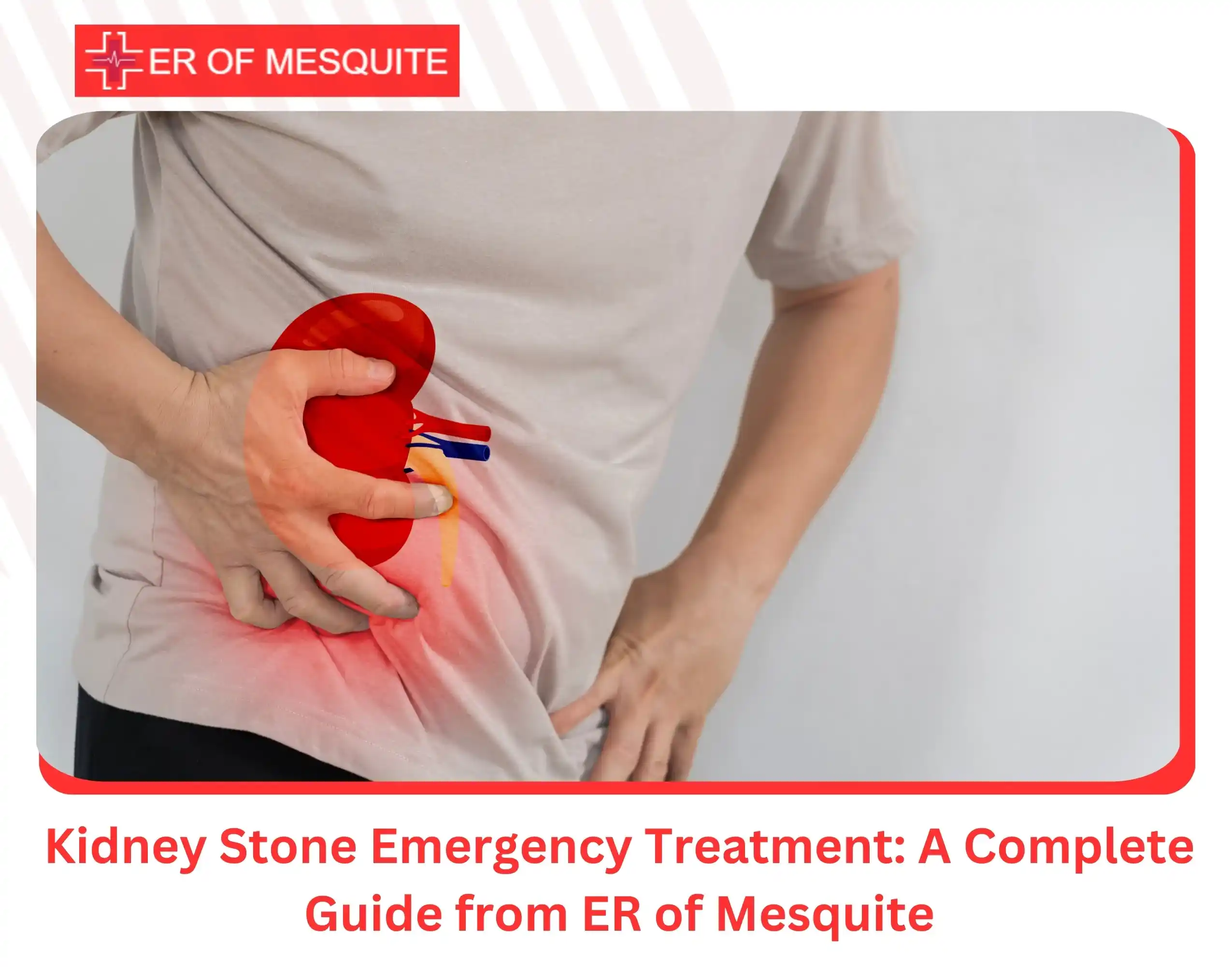 Kidney Stone Emergency Treatment A Complete Guide from ER of Mesquite