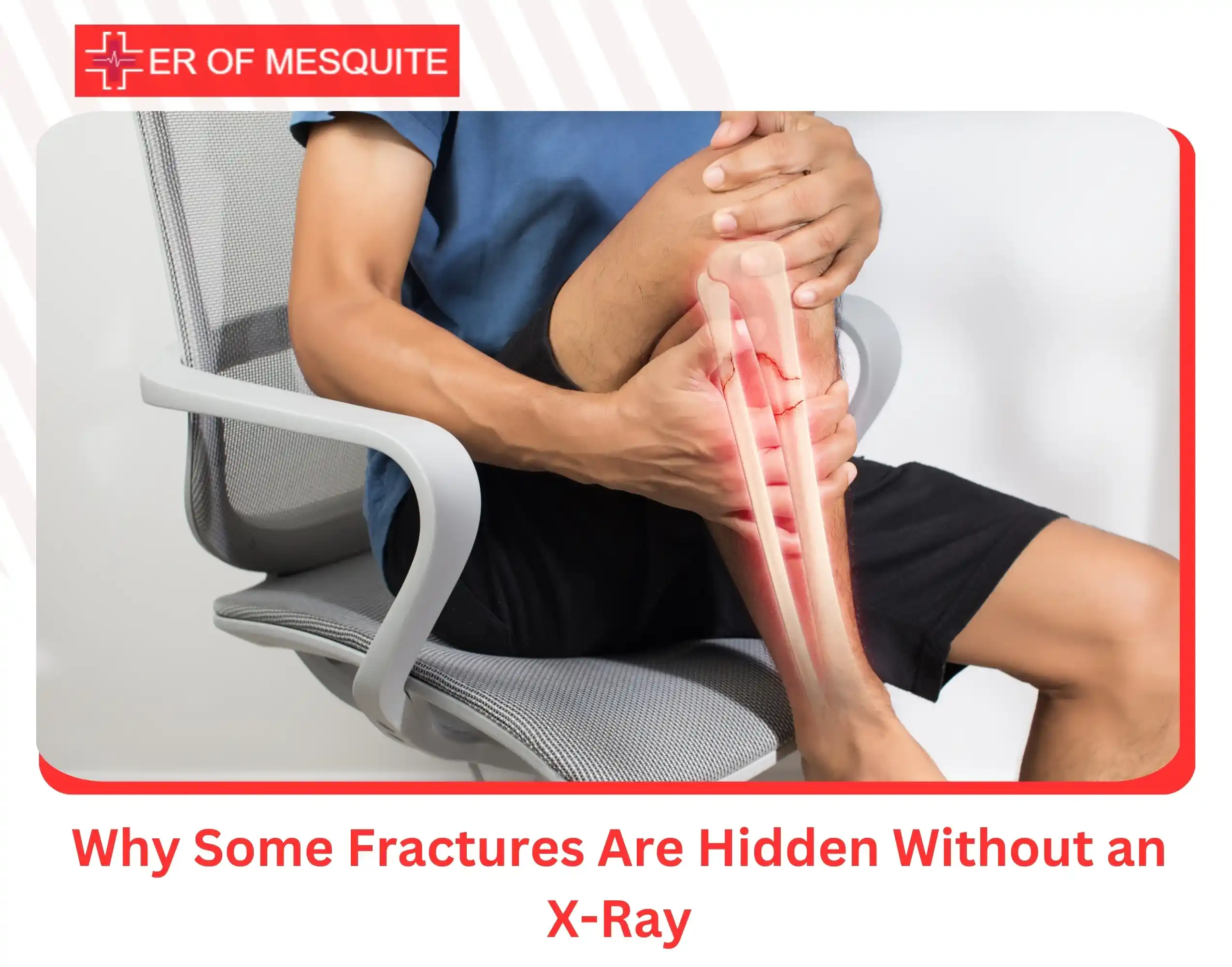 Why Some Fractures Are Hidden Without an X-Ray