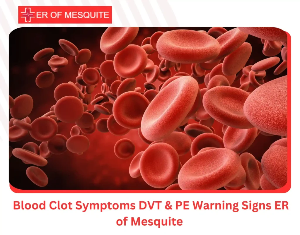 Blood Clot Symptoms DVT & PE Warning Signs ER of Mesquite