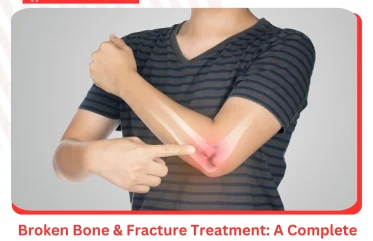 Broken Bone & Fracture Treatment A Complete Guide from ER of Mesquite
