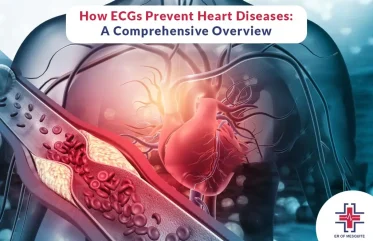 How ECGs Prevent Heart Diseases - A Comprehensive Overview - ER of Mesquite