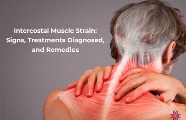 Intercostal Muscle Strain - Signs, Treatments Diagnosed and Remedies - ER of Mesquite