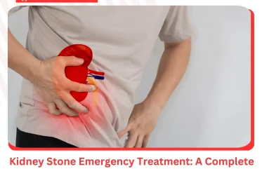 Kidney Stone Emergency Treatment A Complete Guide from ER of Mesquite